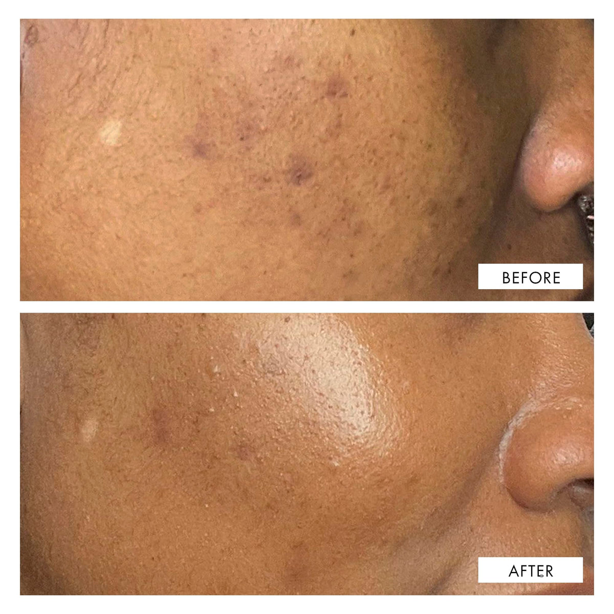 111SKIN Dark Spot Correcting Serum ingredients list