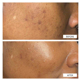 111SKIN Dark Spot Correcting Serum ingredients list