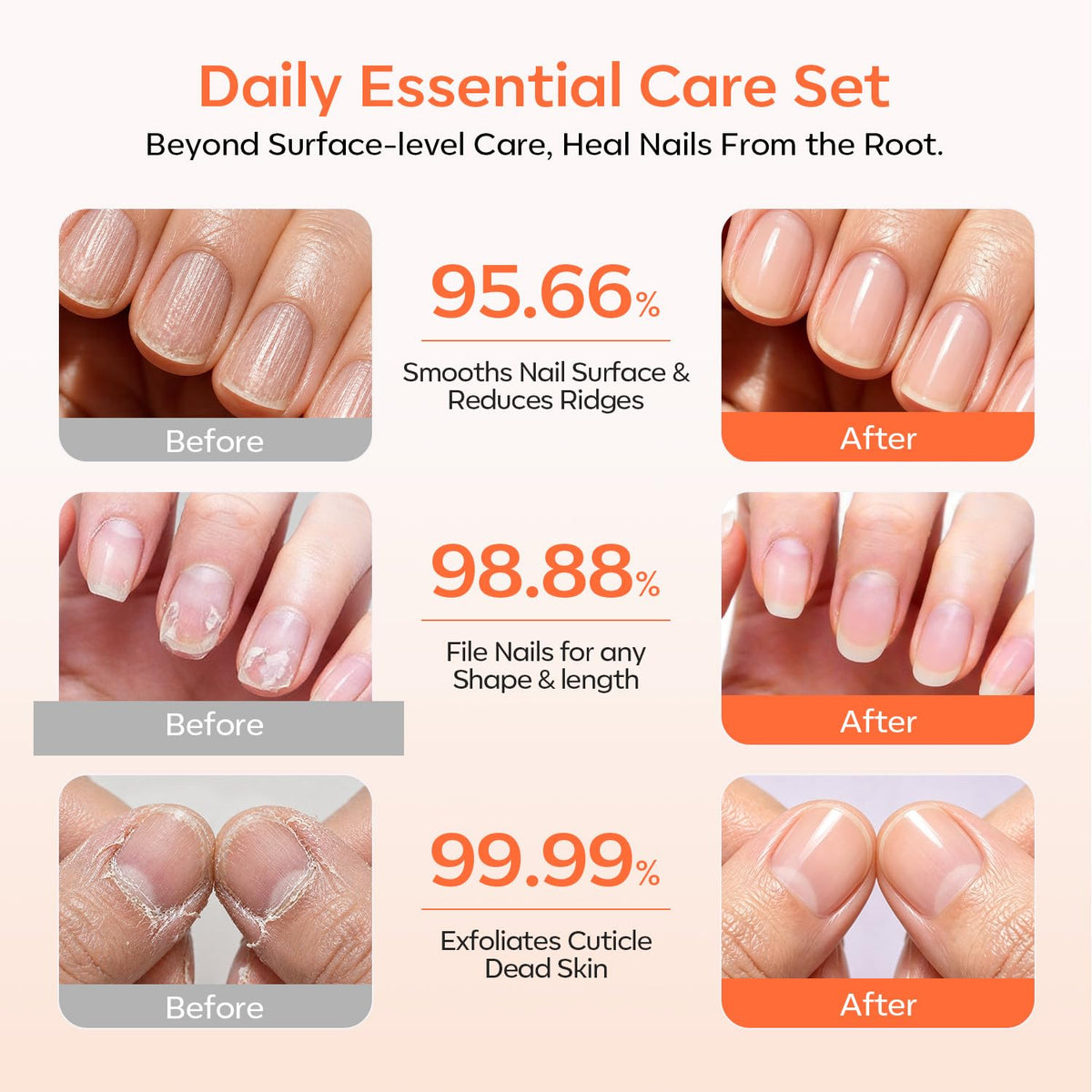 30g cuticle remover cream tube from modelones