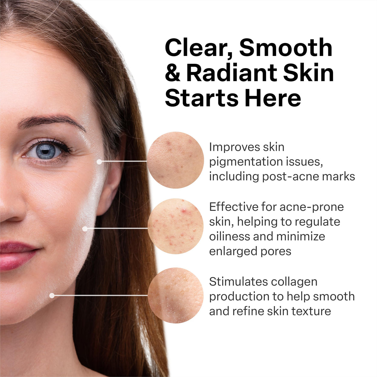 A313 Vitamin A Pommade 50g application on skin