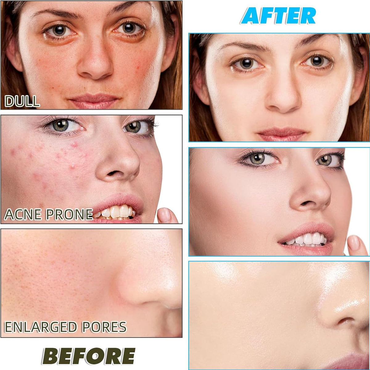 Aacnre Turmeric face scrub pads in use on skin
