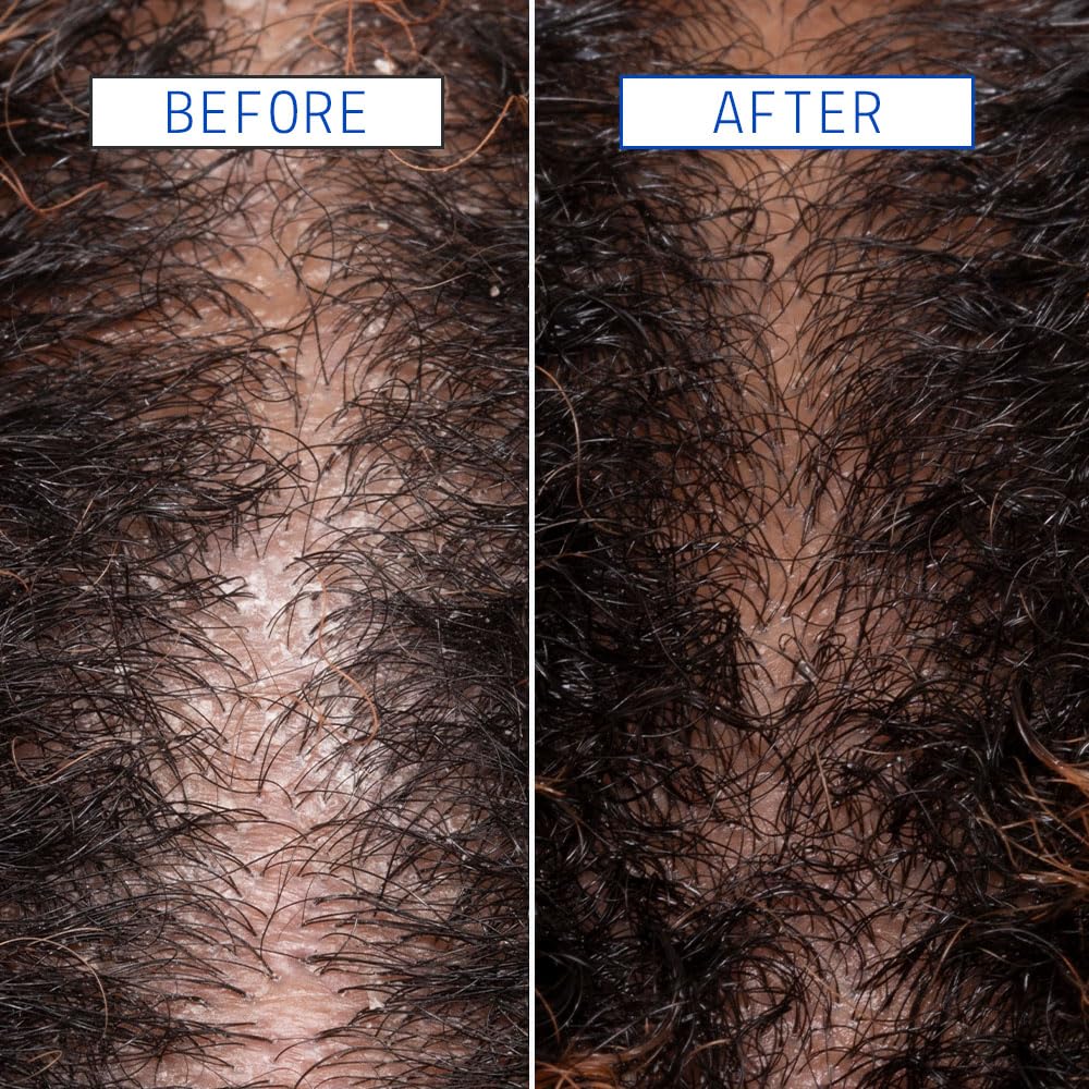 AAVRANI Scalp Detox Jelly Cleanser Tea Tree Shampoo texture close-up