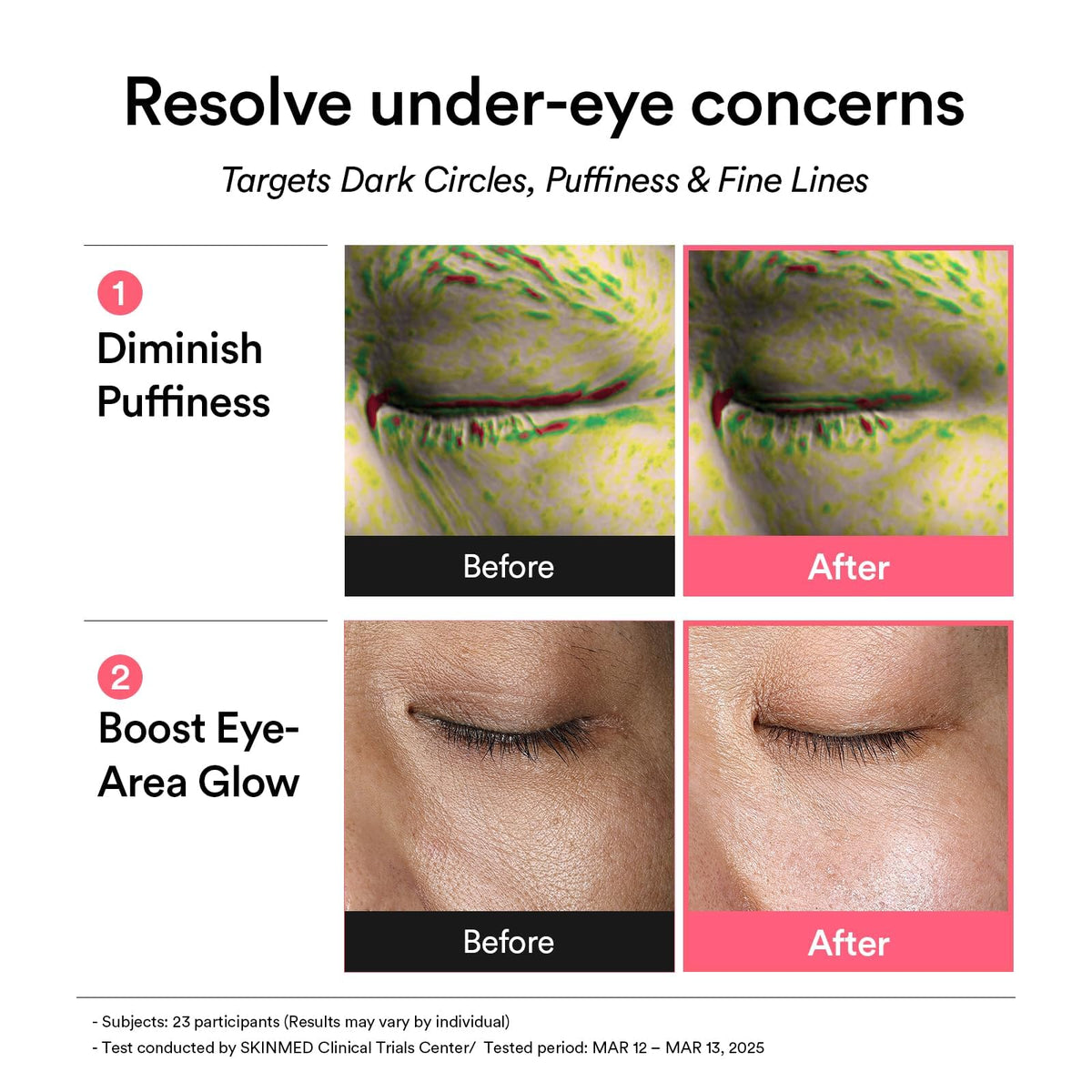 Abib PDRN Retinal Eye Patches on a skincare shelf