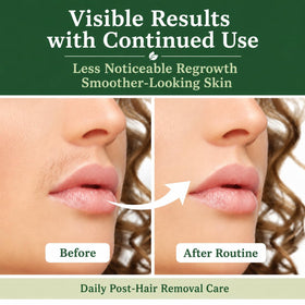 Aemerry Cyperus Rotundus Oil application on skin