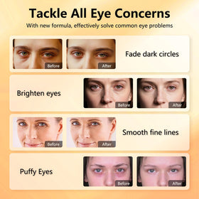 Aeryea Vitamin C & Caffeine Under Eye Patches with ingredients list