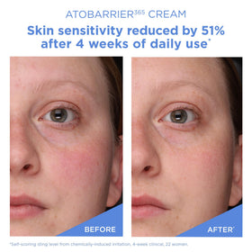AESTURA ATOBARRIER365 Cream lifestyle scene