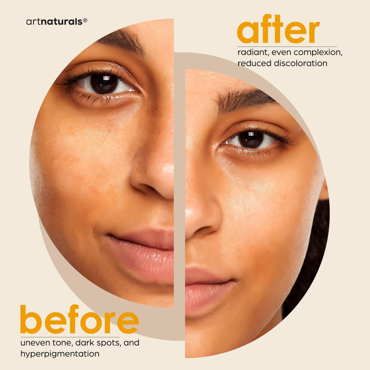 African net sponge included with Artnaturals Kojic Acid Soap