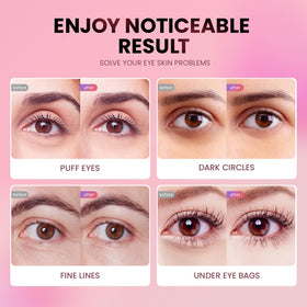 AILEORY Under Eye Patches in refrigerator for cooling