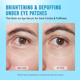 AILEORY Under Eye Patches on a bathroom counter
