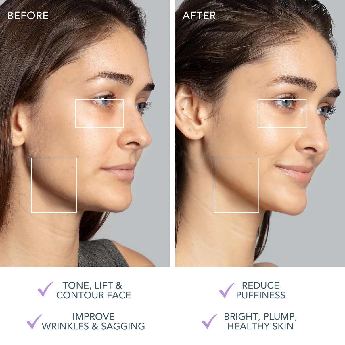 All components of the FOREO Total Facelift Bundle displayed together