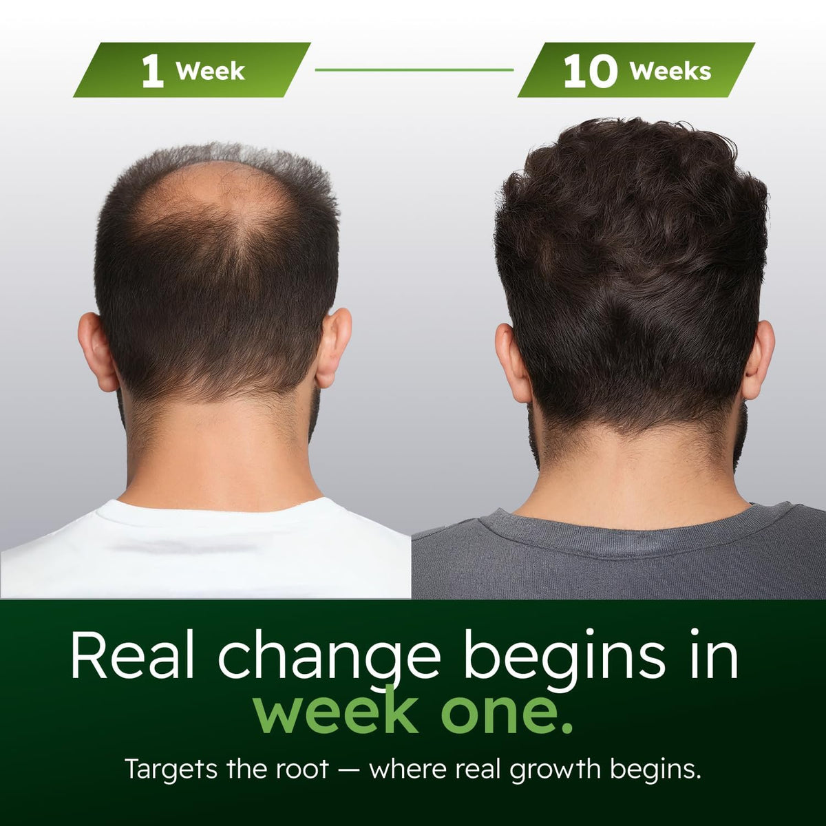 Alphainfuse Hair Serum for Men ingredients list