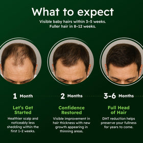 Alphainfuse Hair Serum for Men packaging details