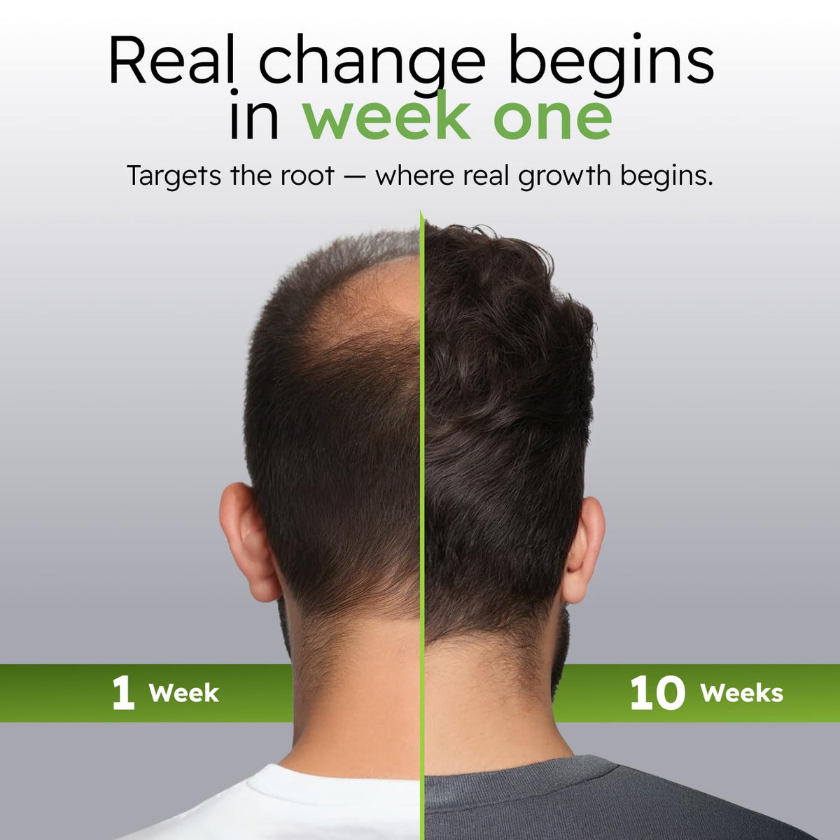 Alphainfuse Hair Serum for Men side view highlighting the bottle design