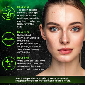 Andlane Star Pimple Patches in a gift box presentation