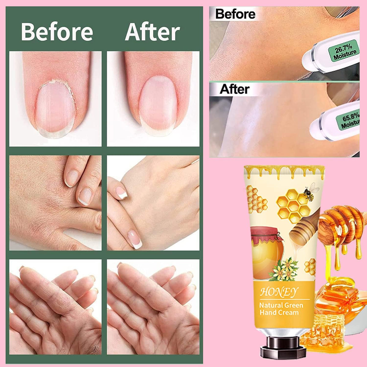 ANKOOY hand cream set displayed outdoors for travel use