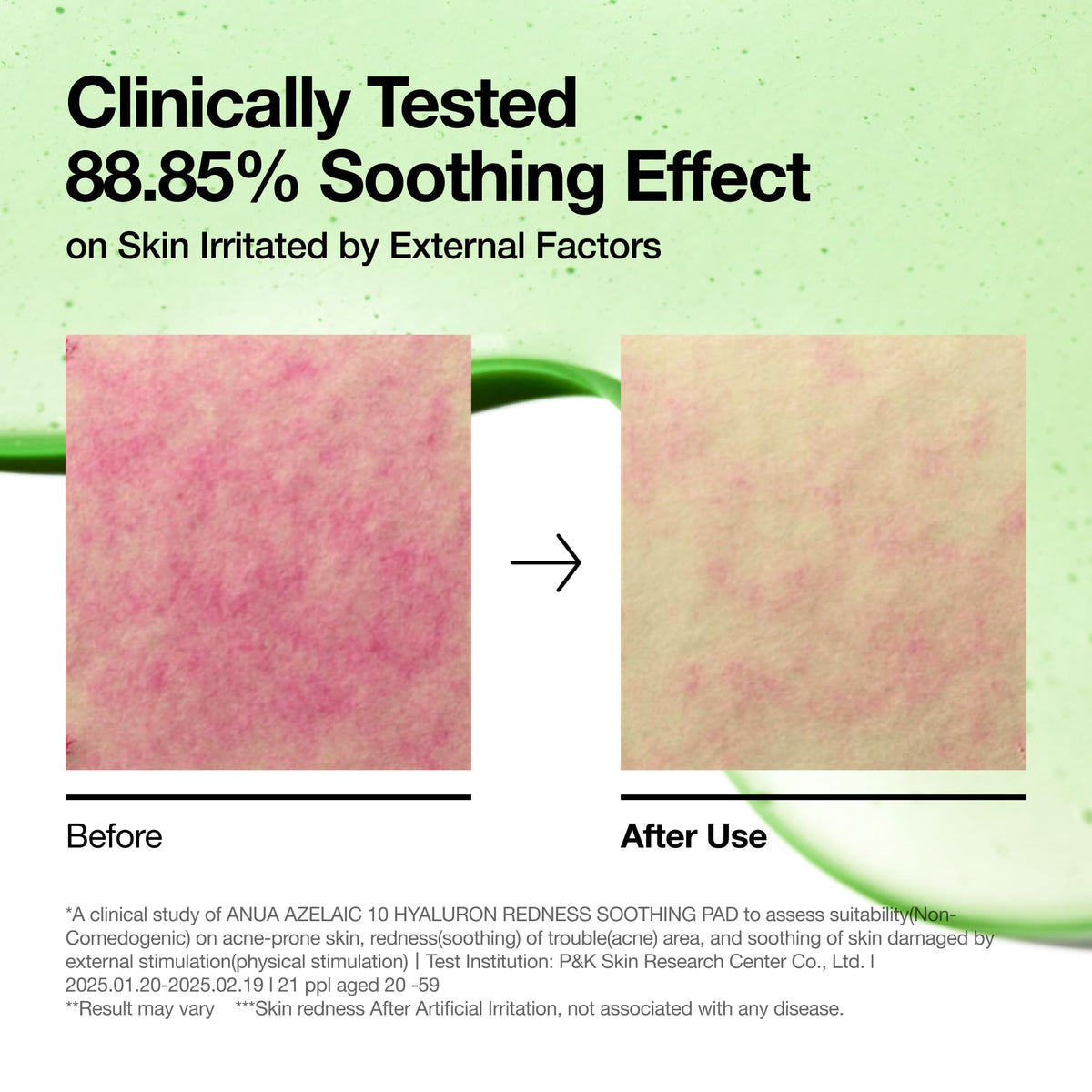 ANUA Azelaic Acid Toner Pads on a bathroom counter