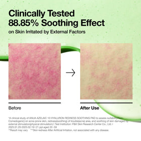 ANUA Azelaic Acid Toner Pads on a bathroom counter