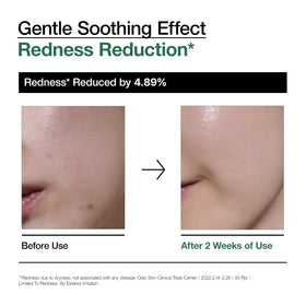 ANUA Heartleaf 80 Soothing Ampoule application on skin