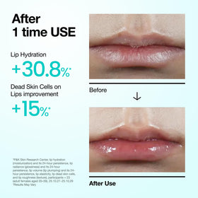 ANUA PDRN Lip Serum on a flat surface with a natural background