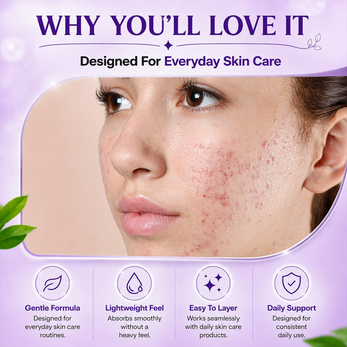 AOBBIY Azelaic Acid Cream ingredients list
