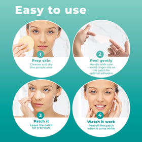 Application of PatchRx Pimple Patches on nose