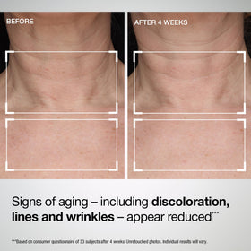 Application of StriVectin TL Advanced Lotion on neck and chest