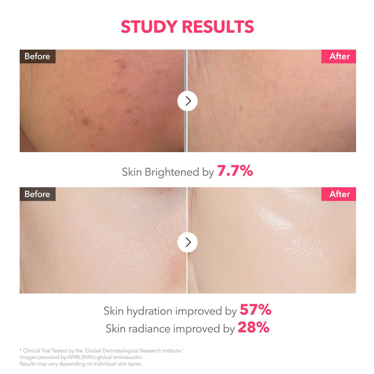 APRILSKIN TXA Pink Capsule Gel Mask ingredients list