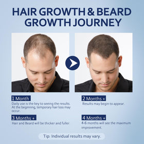 Artimore 5% Minoxidil Hair Growth Serum back view
