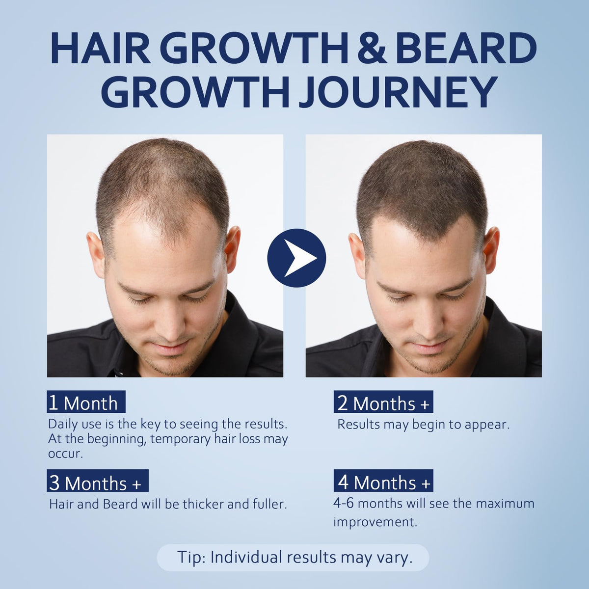 Artimore Minoxidil Hair Growth Serum lifestyle scene on bathroom counter