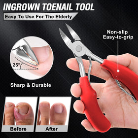 Aucurwen 360° rotating ingrown toenail tool close-up