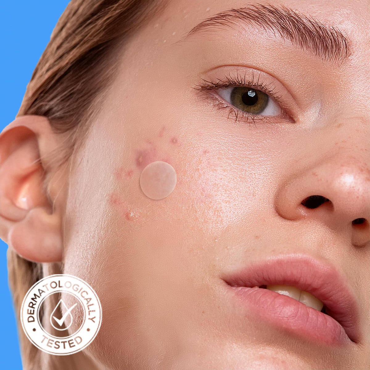 AVARELLE Hydrocolloid Patches close-up