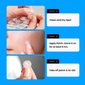 AVARELLE Hydrocolloid Pimple Patches resealable pouch