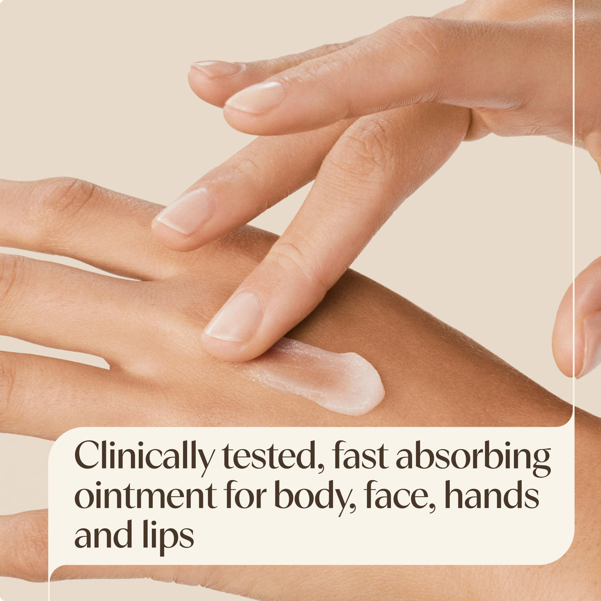 Aveeno Skin Relief Healing Ointment on hands