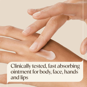 Aveeno Skin Relief Healing Ointment on hands