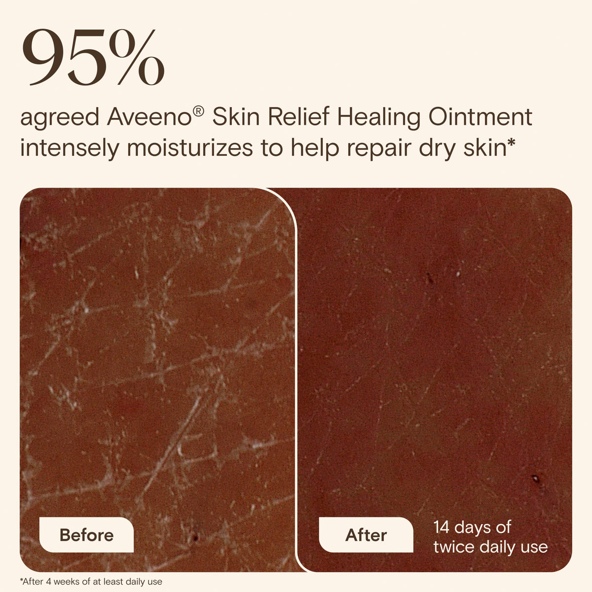 Aveeno Skin Relief Healing Ointment packaging