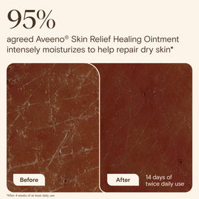 Aveeno Skin Relief Healing Ointment packaging