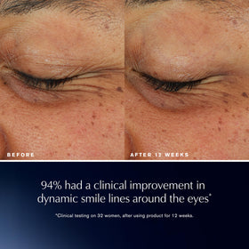 Back view of Estée Lauder Advanced Night Repair Eye Lift packaging