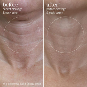 Back view of THISWORKS Perfect Cleavage & Neck Serum packaging