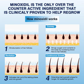 Back view of YKDYLINH Minoxidil Foam packaging
