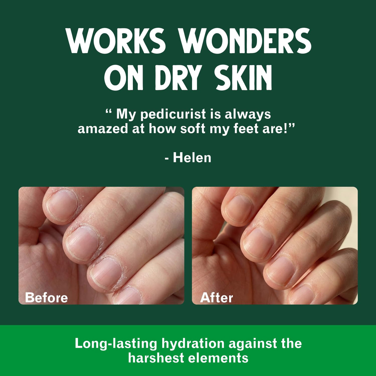Bag Balm Original Skin Moisturizer applied to dry hands