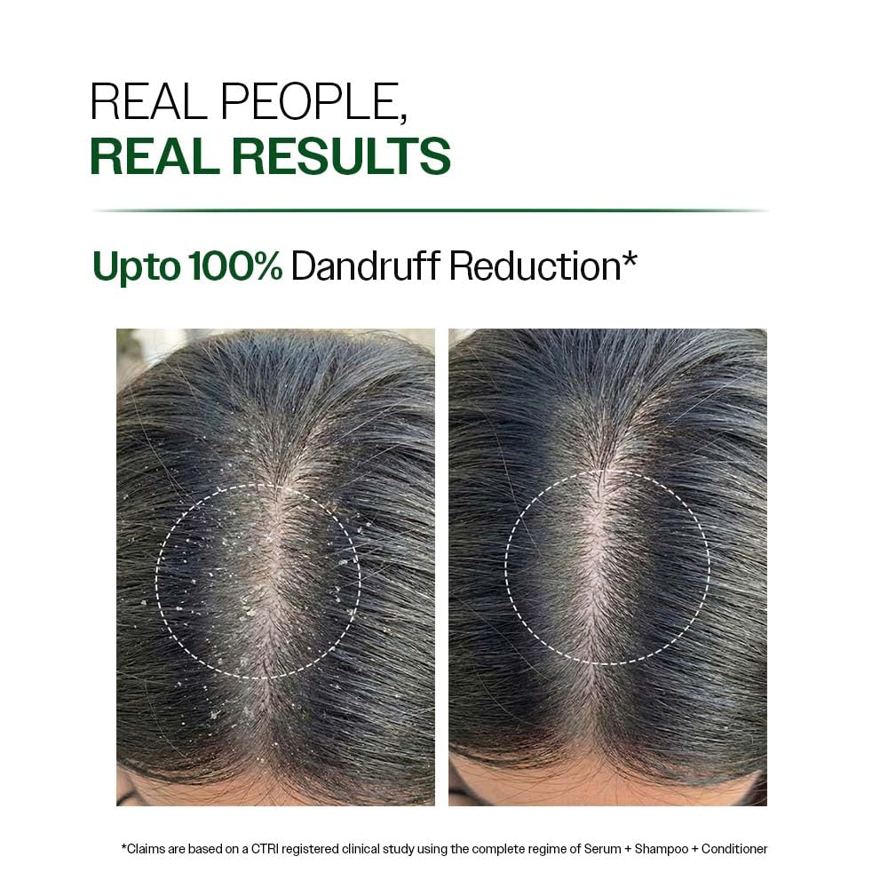 Bare Anatomy Anti Dandruff Shampoo back view