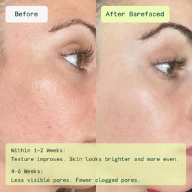 Barefaced Toning and Exfoliating Pads inside view showing pads
