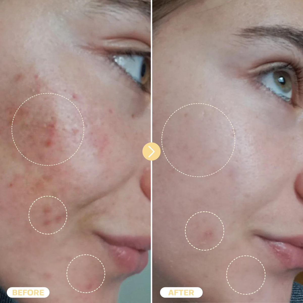BASE LABORATORIES Hypochlorous Acid Spray application on skin