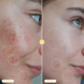 BASE LABORATORIES Hypochlorous Acid Spray application on skin