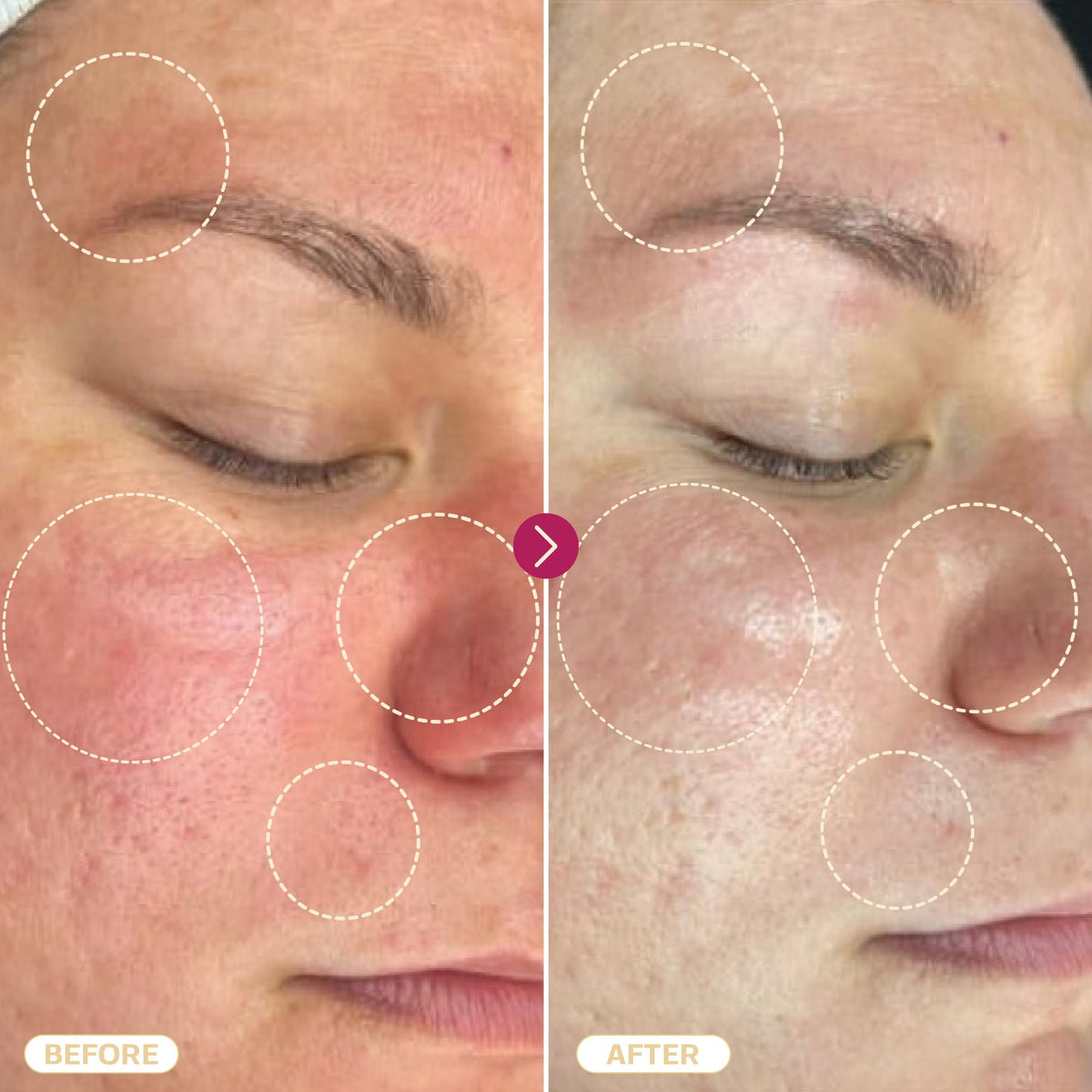 BASE LABORATORIES Hypochlorous Acid Spray in a skincare routine
