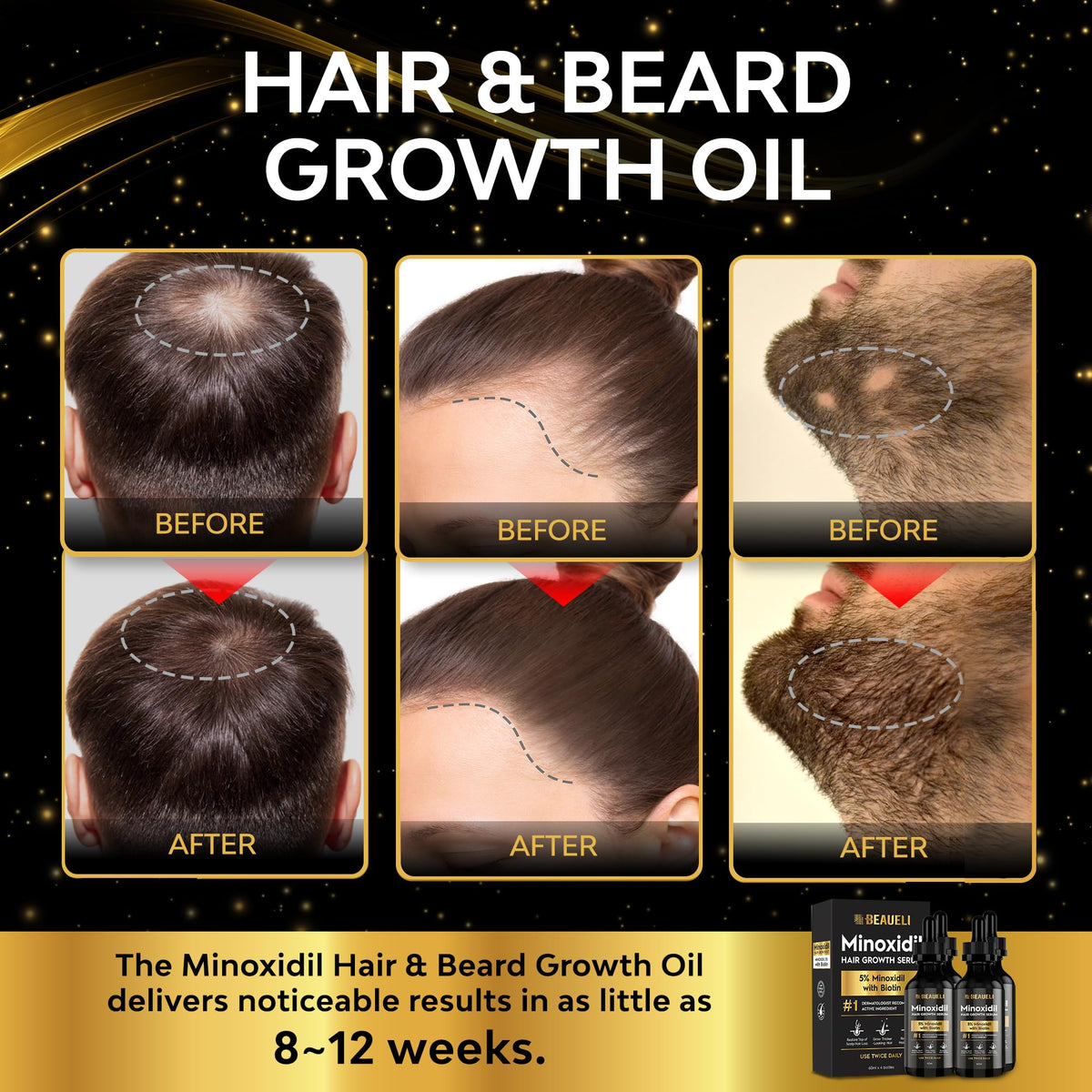 beaueli 5% Minoxidil Hair Growth Serum bottle side view