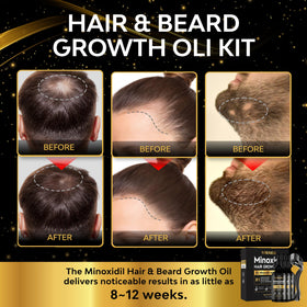 beaueli Beard Growth Kit packaging showing product details
