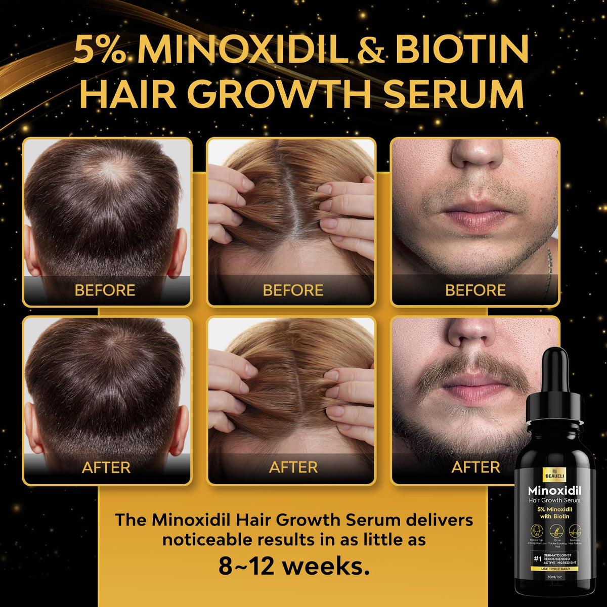beaueli Hair Growth Serum 5% Minoxidil side view