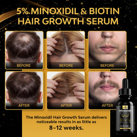 beaueli Hair Growth Serum 5% Minoxidil side view