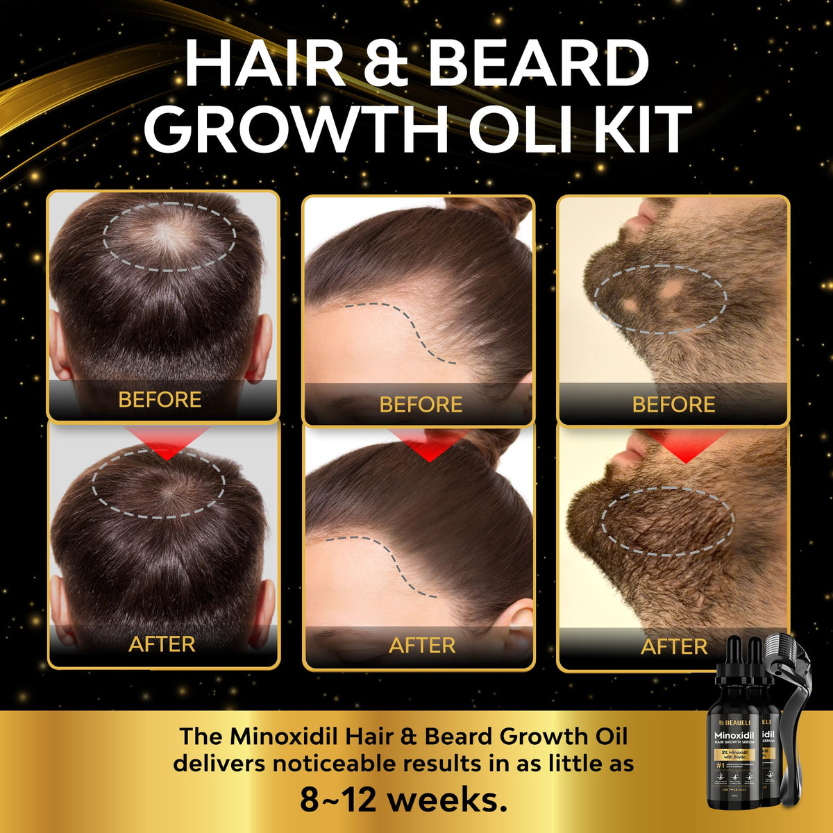 beaueli Minoxidil Beard Growth Kit 5% 60ml back view